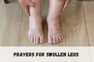17 Prayers  for Swollen Legs: Experience an Heavenly Touch