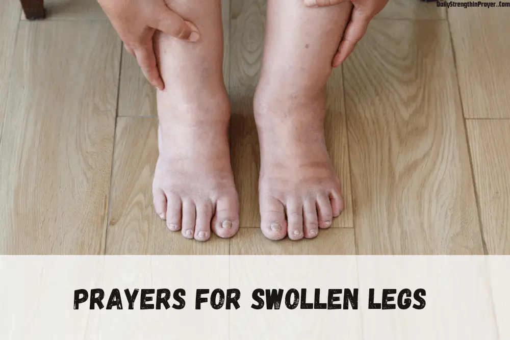Prayer for swollen legs