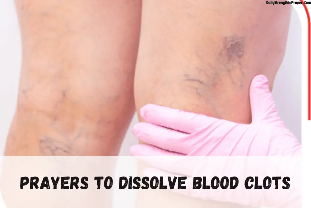 Prayer to dissolve blood clots