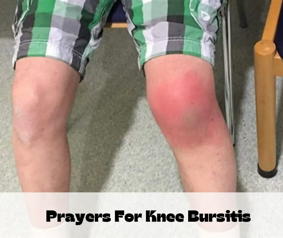 Prayers For Knee Bursitis